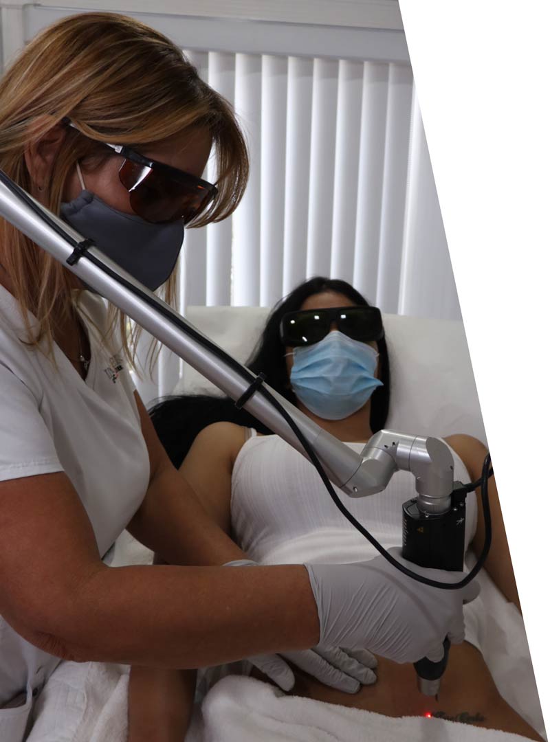 Idealaser Cosmetic Center, Q-Switched NdYag lasers,