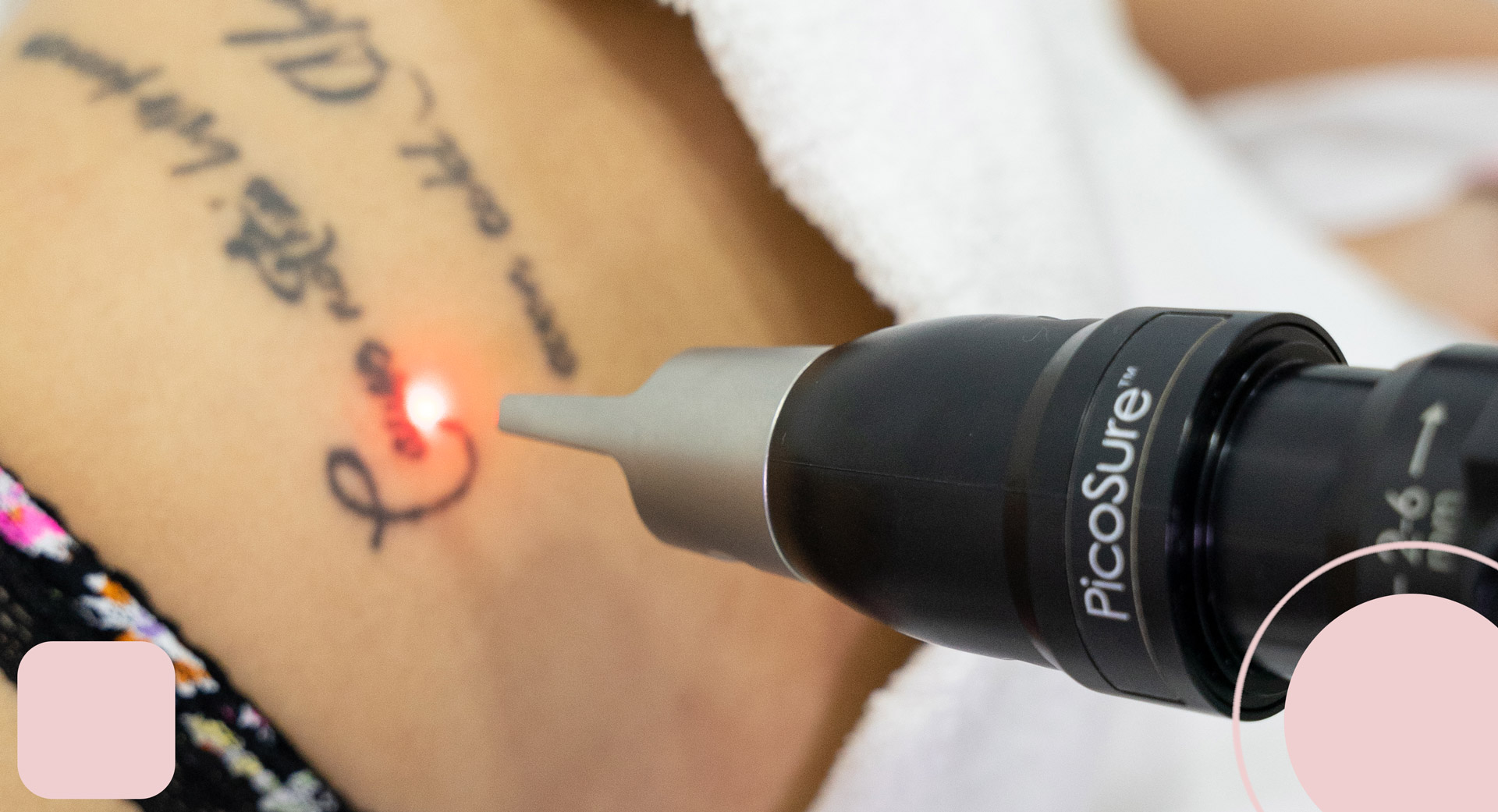 laser tattoo removal, tattoo laser removal